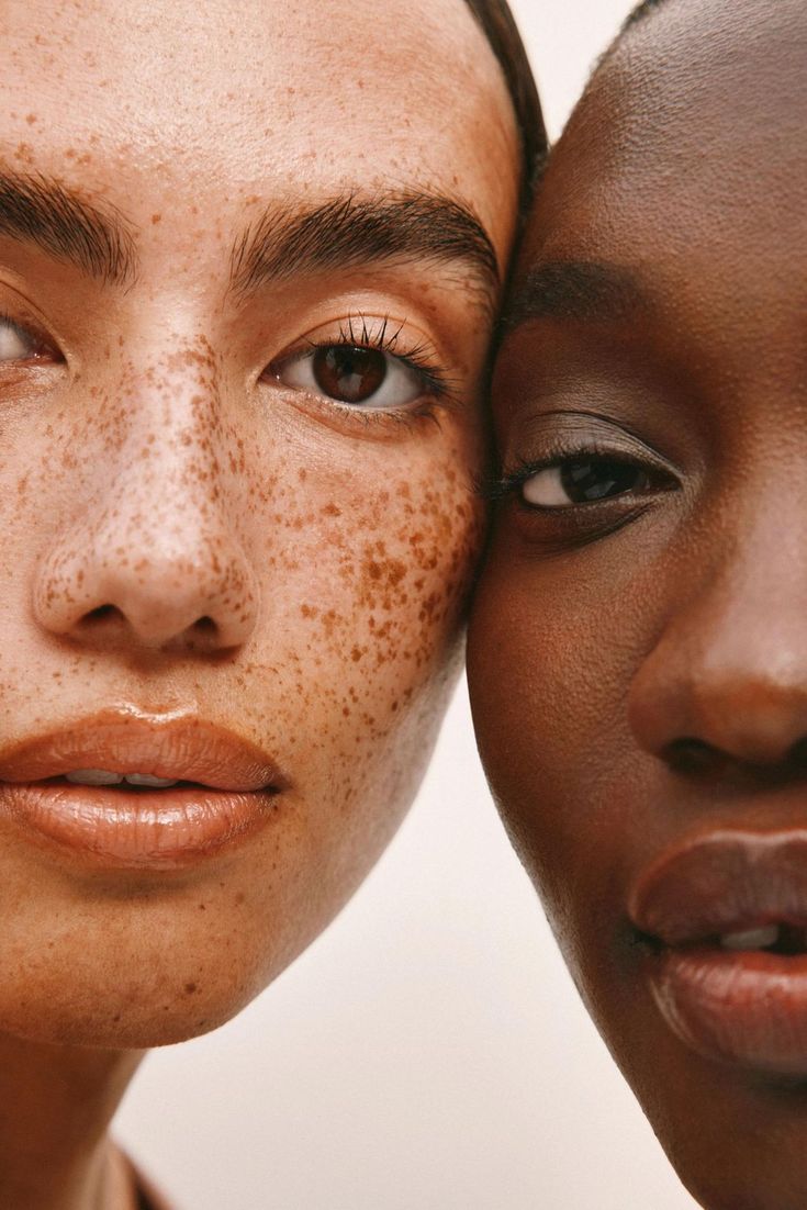 Is Chronic Stress Making Your Skin Dull?