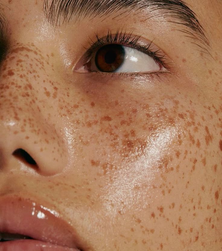 The After-Sun Skincare Routine Your Skin Actually Needs